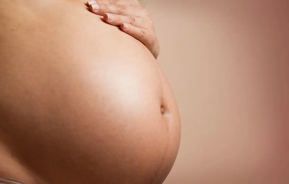 grossesse  vergetures